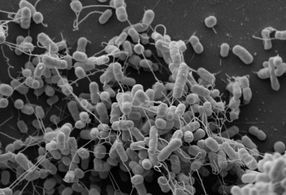 Escherichia coli und Acinetobacter baylyi tauschen Aminosäuren über Nanokanäle aus