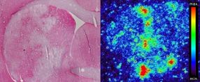 Autoradiograph of a brain section of a laboratory mouse after a Stroke