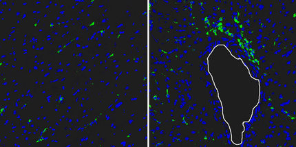 Reg3beta lockt weiße Blutkörperchen ins Infarktgebiet