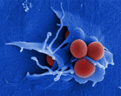 Methicillin-resistant Staphylococcus aureus