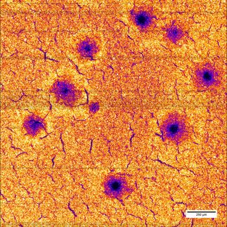 Fast charging cycles make batteries age more quickly