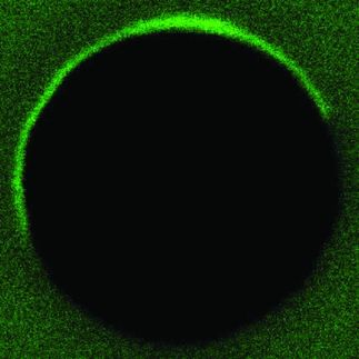 Green fluorescence of tagged proteins