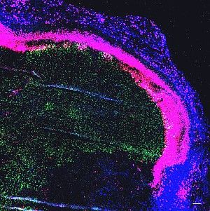 Bakterien helfen dem Immunsystem im Kampf gegen Krebs auf die Sprünge