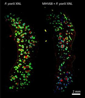 immune-fluorescence staining of cross section of whole spleen