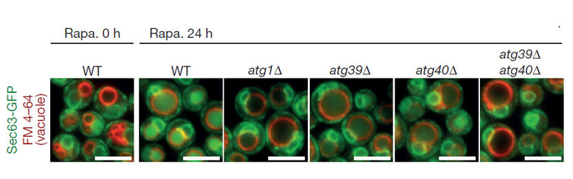 Fluorescence microscopy images of yeast cells