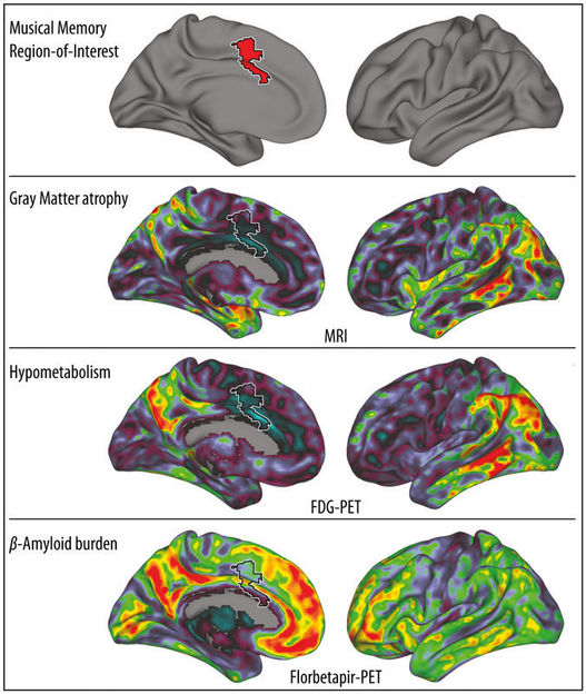 © MPI f. Kognitions- und Neuroswissenschaften