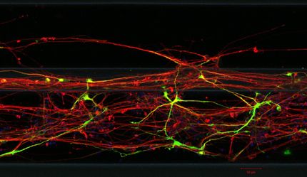 Drug discovery for Parkinson’s disease: Researchers Grow Neurons in 3D