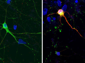 Nervenzellen, abgeleitet von iPS-Zellen