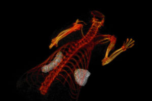 E2-Crimson expressing tumour cells
