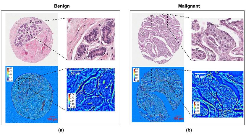 Hassaan Majeed, Univ. of Illinois, et al./SPIE