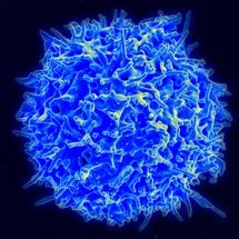 T lymphocyte blood cancer