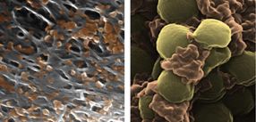 platelets nanomedicine