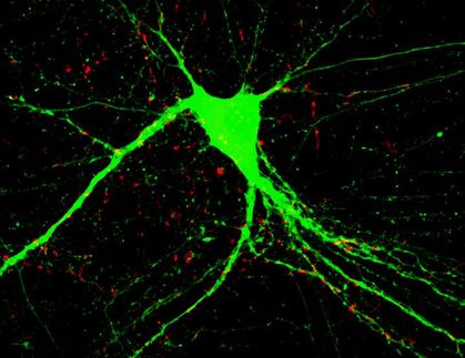 neurons brain repair schizophrenia