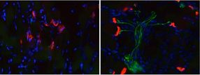 pediatrics motor neurons