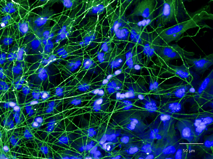 Aus menschlichen iPS-Zellen generierte Nervenzellen
