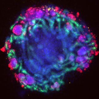 organoids kidney