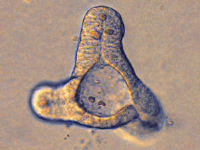 Mini-intestine grown in a test tube