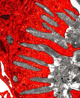 Entzündungsforschung: Riesenzellen räumen auf
