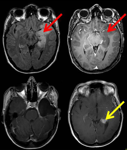 © Foto: M. Simon/Neurochirurgie/UKB