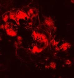 glaucoma stem cells