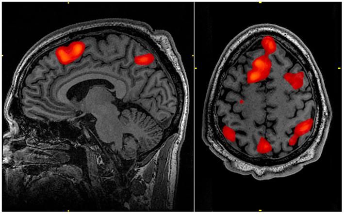 Researchers developing brain-mapping technology