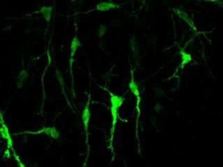 Laboratory of Developmental Neurobiology at The Rockefeller University/Neuron