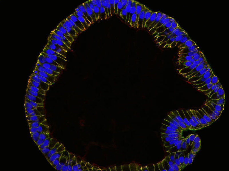 © MPI f. Infektionsbiologie