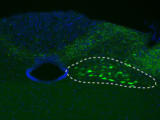 Parkinson: Neue Erkenntnisse über ein reisendes Protein - „Alpha-Synuclein“, ein für die Parkinson-Erkrankung wichtiges Protein, verhält sich nicht wie ein Prion