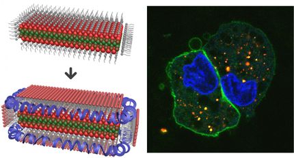 lipoproteins imaging