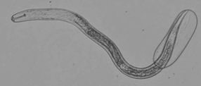 nematodes neurology