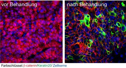 Wie Krebsstammzellen umprogrammiert werden