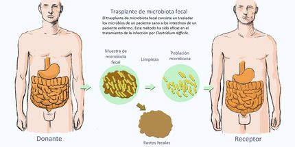 Una nueva técnica mejora la eficacia del trasplante de microbiota fecal intestinal