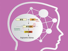 'Gene fusion' mutation uses 3-way mechanism to drive childhood brain cancers