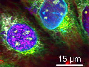 Microscopy: Nine at one blow