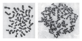 Der Regulation des Brustkrebsgens BRCA1 auf der Spur