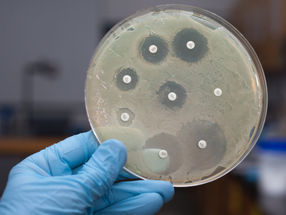 Extrem resistenter Tuberkulose-Erreger entwickelt weitere Resistenzen gegen neue Antibiotika