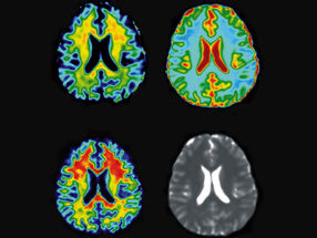 MRT-Bildgebung des Gehirns