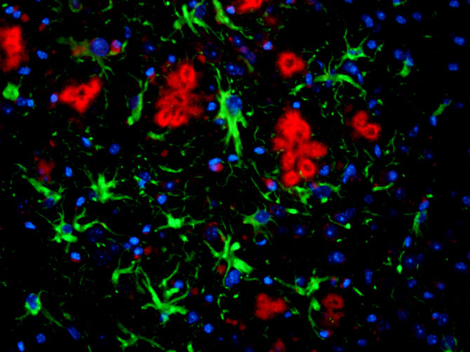 © Foto: Abteilung für Neurologie/Universität Bonn