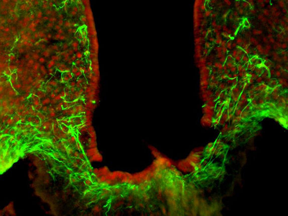 Neuer Schalter für das Sättigungsgefühl entdeckt