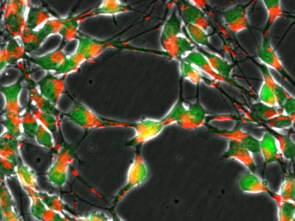 Neue Ansätze für Parkinson-Therapie?