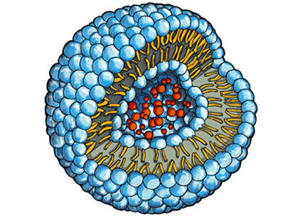 Soap bubbles for treating stenosed blood vessels