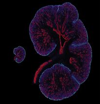 Researchers discover a key difference between mouse and human kidney cells