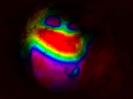 Live-imaging technique for mice seen as boost to studies of brain function and development
