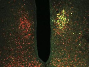 Using magnetic forces to control neurons, study finds brain is vital in glucose metabolism