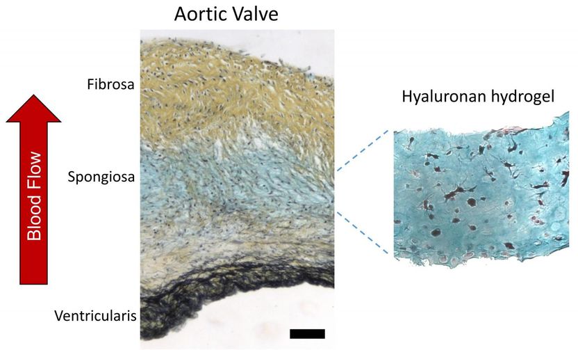 Study probes heart of synthetic heart valves