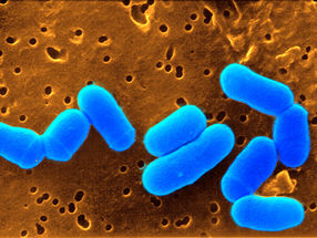 Bakterien-Gen sorgt für Balance