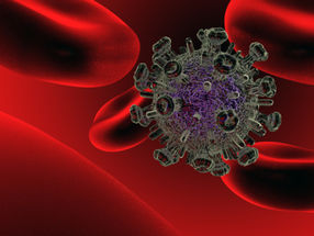 Representación del virus del VIH.