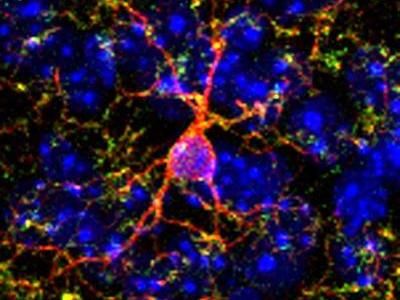Mechanism that reduces effect of cocaine on brain discovered