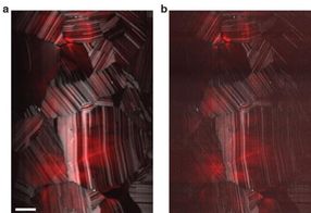 Beating the limits of the light microscope, one photon at a time