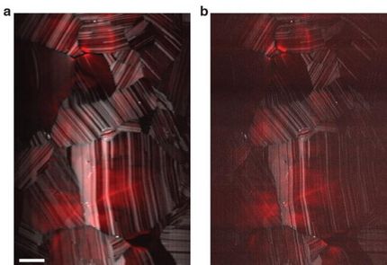 Beating the limits of the light microscope, one photon at a time